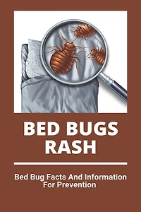 Bed Bugs Rash: Bed Bug Facts And Information For Prevention: Exterminator Bugs