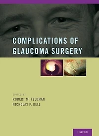 Complications of Glaucoma Surgery