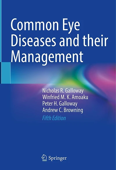 Common Eye Diseases And Their Management