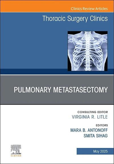 Pulmonary Metastasectomy, An Issue of Thoracic Surgery Clinics