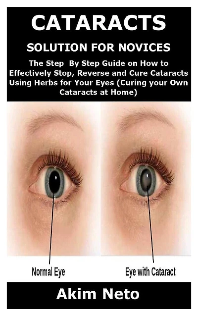 Cataracts Solution for Novices: The Step By Step Guide on How to Effectively Stop, Reverse and Cure Cataracts Using Herbs for Your Eyes (Curing your Own Cataracts at Home)