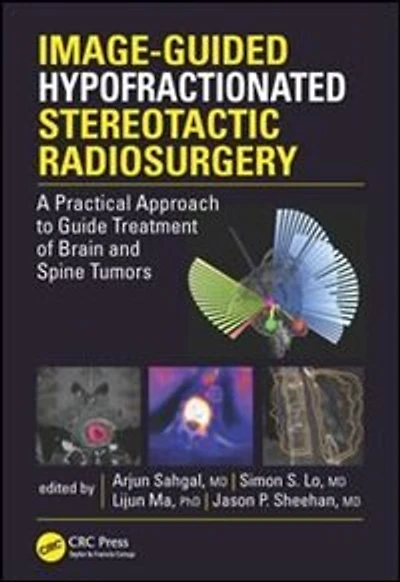 Image-Guided Hypofractionated Stereotactic Radiosurgery: A Practical Approach to Guide Treatment of Brain and Spine Tumo: Tumors