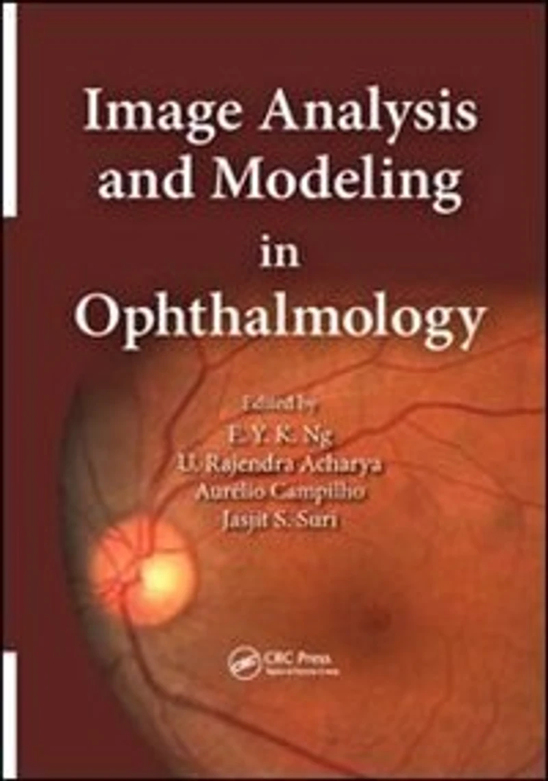 Image Analysis and Modeling Ophthalmology