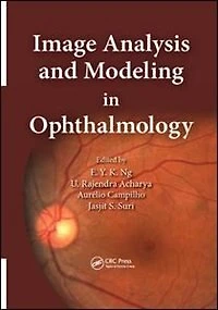 Image Analysis and Modeling Ophthalmology