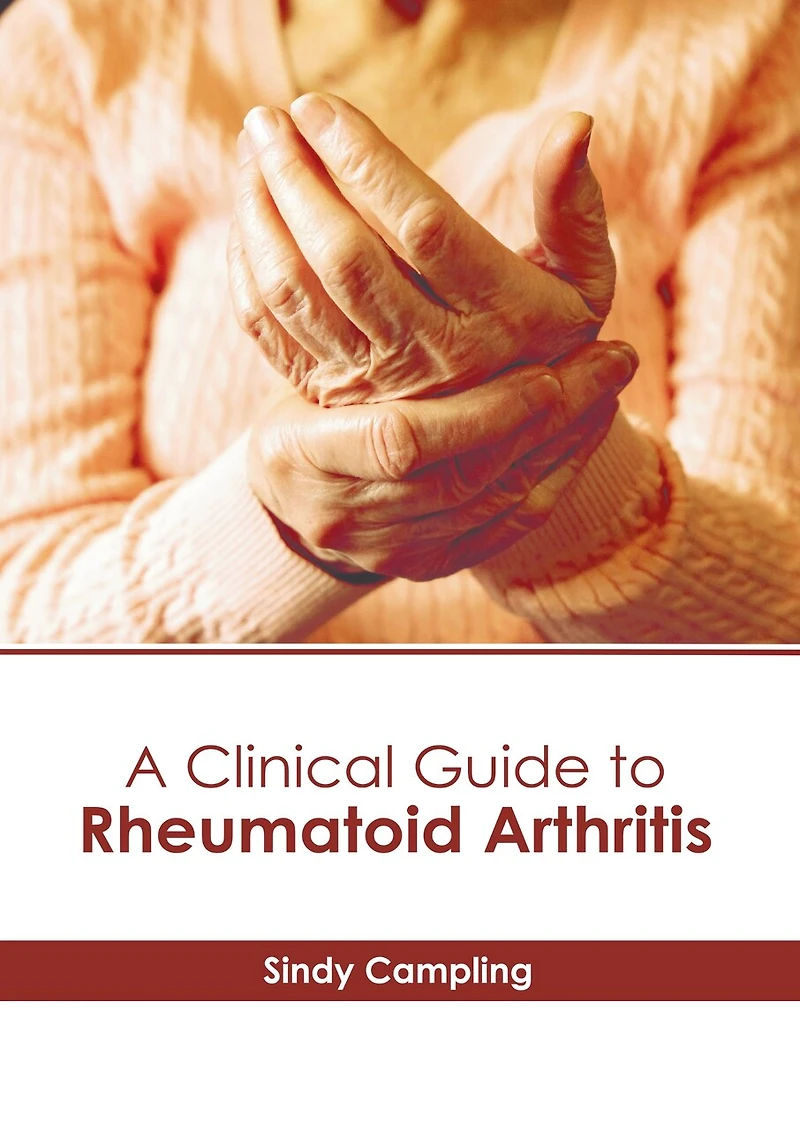 A Clinical Guide to Rheumatoid Arthritis