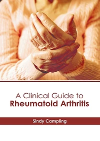 A Clinical Guide to Rheumatoid Arthritis