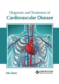 Diagnosis and Treatment of Cardiovascular Disease