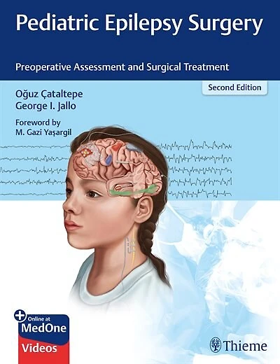 Pediatric Epilepsy Surgery: Preoperative Assessment And Surgical Treatment