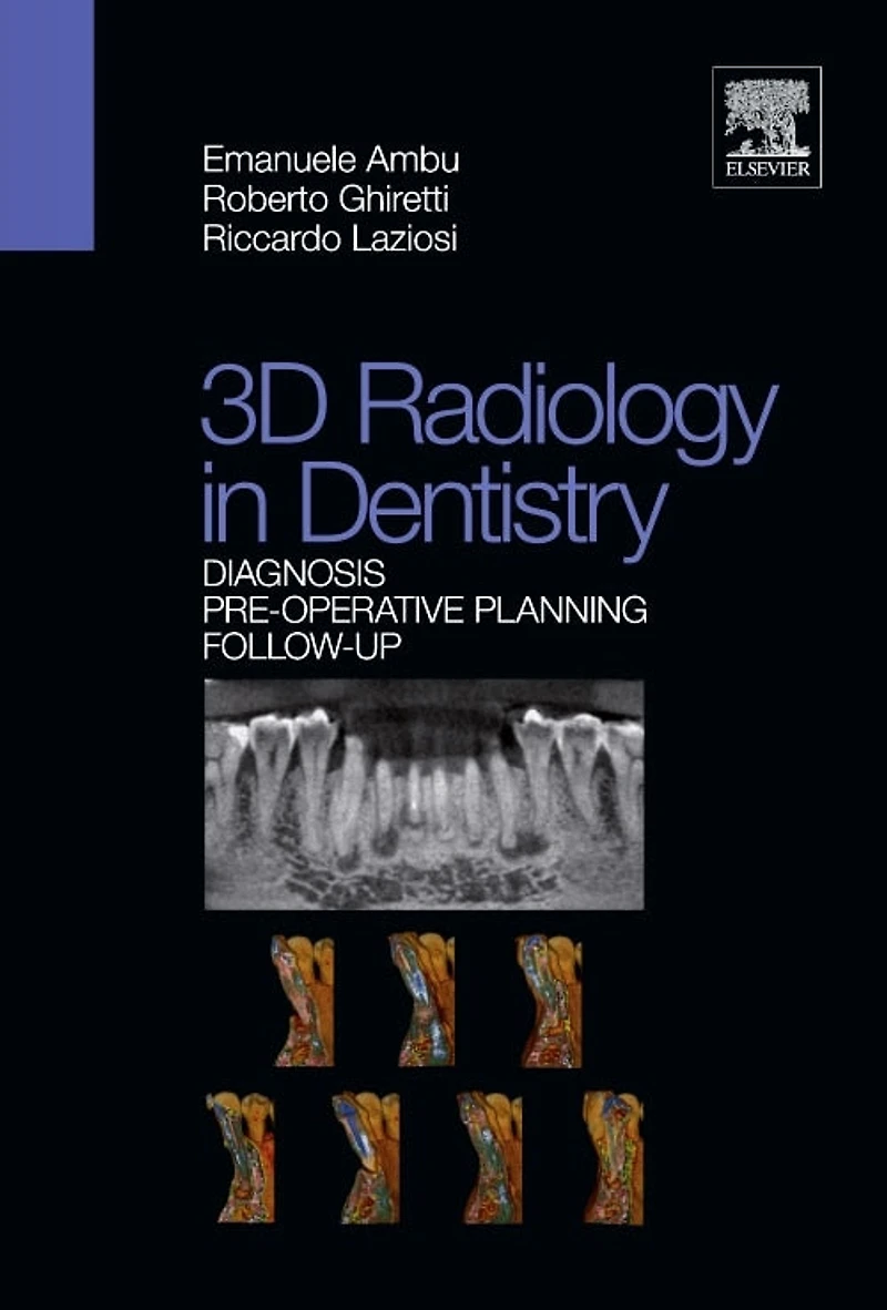 3D Radiology Dentistry - Diagnosis Pre-Operative Planning Follow-Up