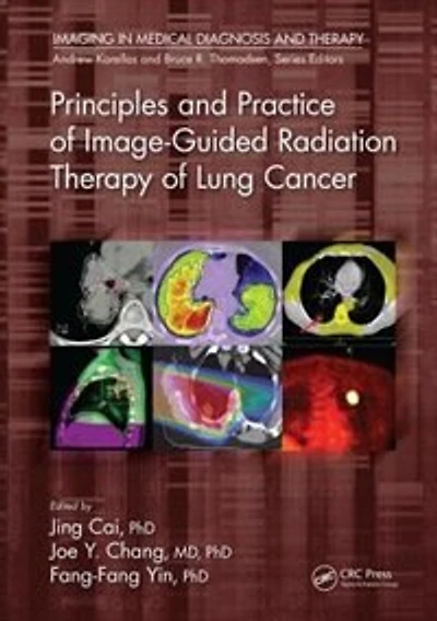 Principles And Practice Of Image-guided Radiation Therapy Lung Cancer