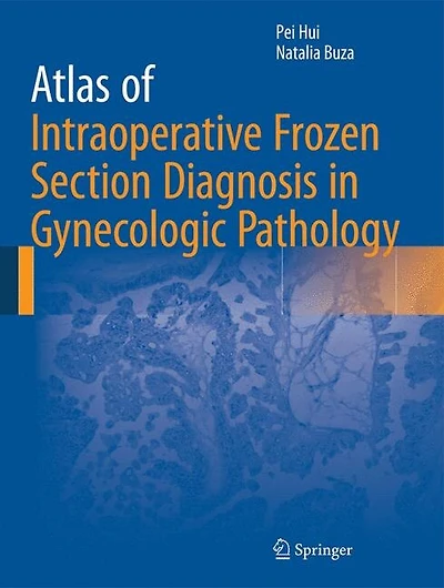 Atlas of Intraoperative Frozen Section Diagnosis Gynecologic Pathology