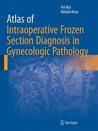 Atlas of Intraoperative Frozen Section Diagnosis Gynecologic Pathology