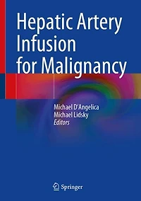 Hepatic Arterial Infusion for Malignancy