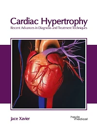 Cardiac Hypertrophy: Recent Advances In Diagnosis And Treatment Techniques