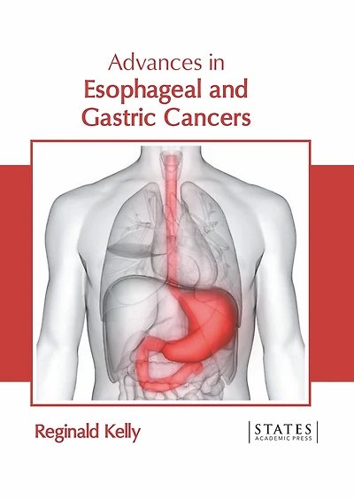 Advances In Esophageal And Gastric Cancers