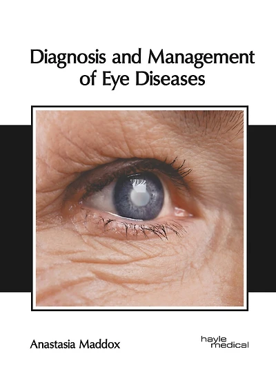 Diagnosis And Management Of Eye Diseases