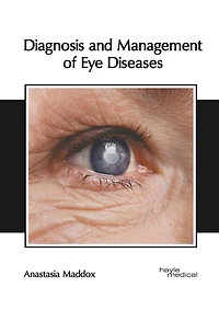 Diagnosis And Management Of Eye Diseases