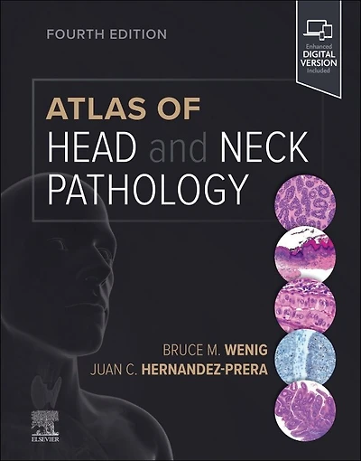 Atlas Of Head And Neck Pathology