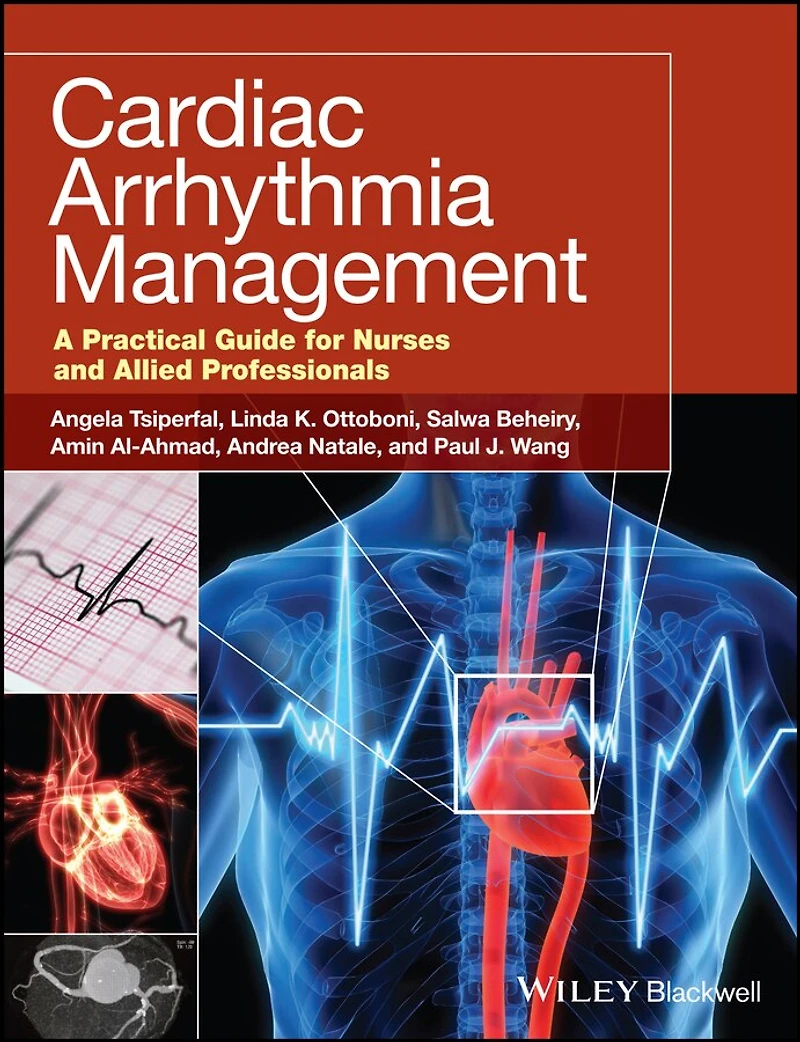Cardiac Arrhythmia Management: A Practical Guide for Nurses and Allied Professionals