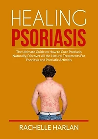 Healing Psoriasis: The Ultimate Guide on How to Cure Psoriasis Naturally, Discover All the Natural Treatments For Psoriasis and Psoriatic Arthritis
