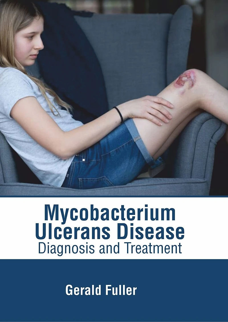 Mycobacterium Ulcerans Disease: Diagnosis And Treatment