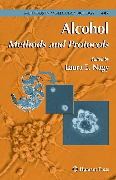 Alcohol: Methods and Protocols