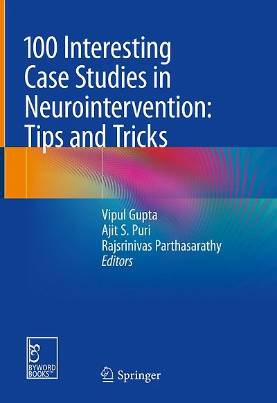 100 Interesting Case Studies Neurointervention: Tips And Tricks