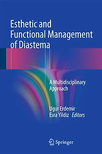 Esthetic and Functional Management of Diastema: A Multidisciplinary Approach