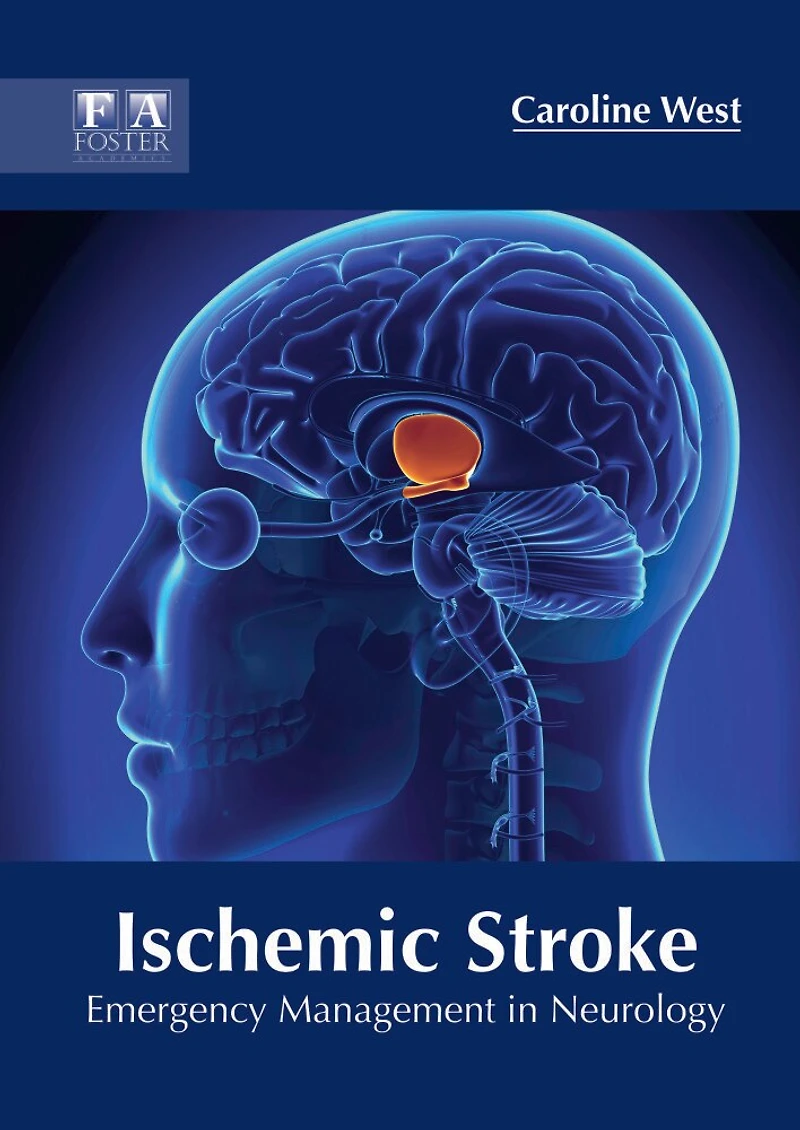 Ischemic Stroke: Emergency Management In Neurology