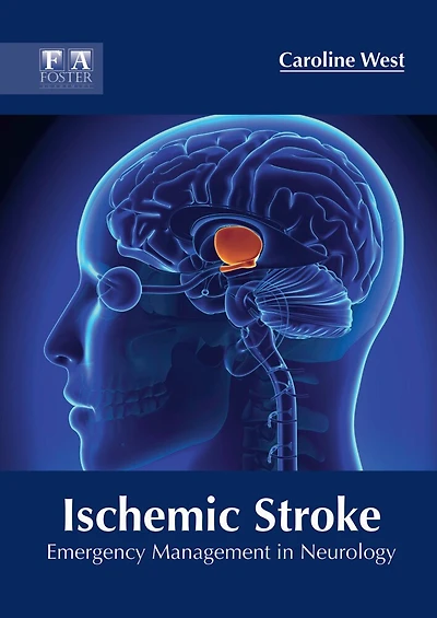 Ischemic Stroke: Emergency Management In Neurology