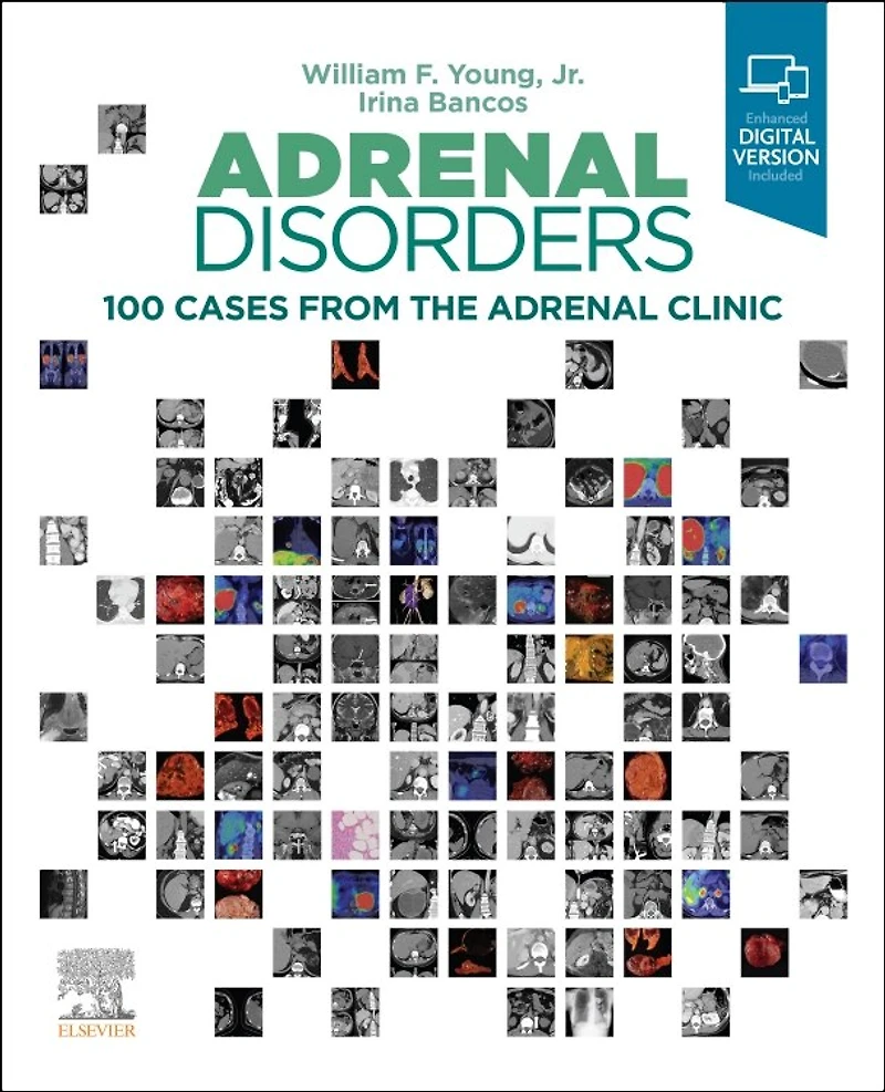 Adrenal Disorders: 100 Cases From The Clinic