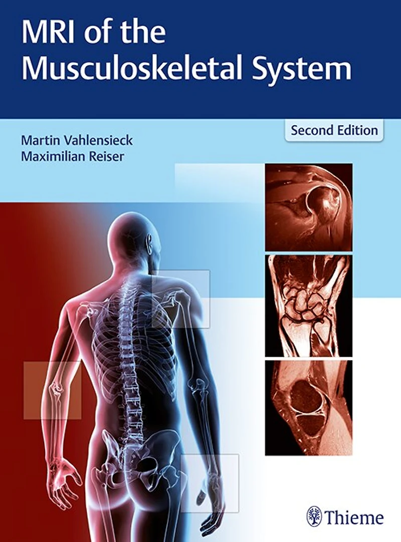 Mri Of The Musculoskeletal System