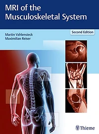 Mri Of The Musculoskeletal System