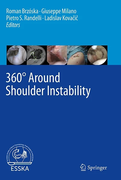 360 Around Shoulder Instability