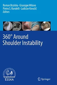 360 Around Shoulder Instability
