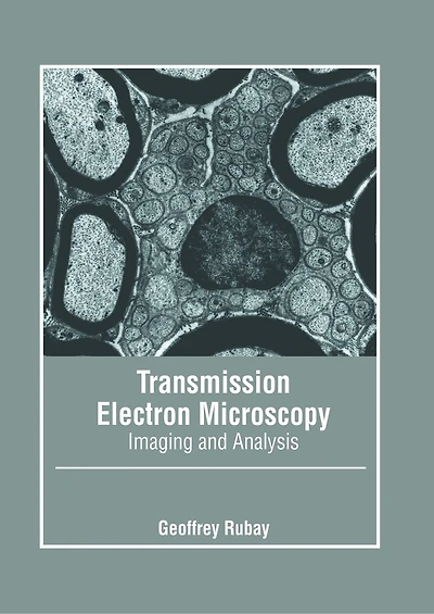 Transmission Electron Microscopy: Imaging and Analysis