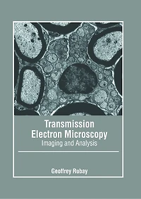 Transmission Electron Microscopy: Imaging and Analysis