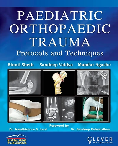 "PAEDIATRIC ORTHOPAEDIC TRAUMA Protocols and Techniques"