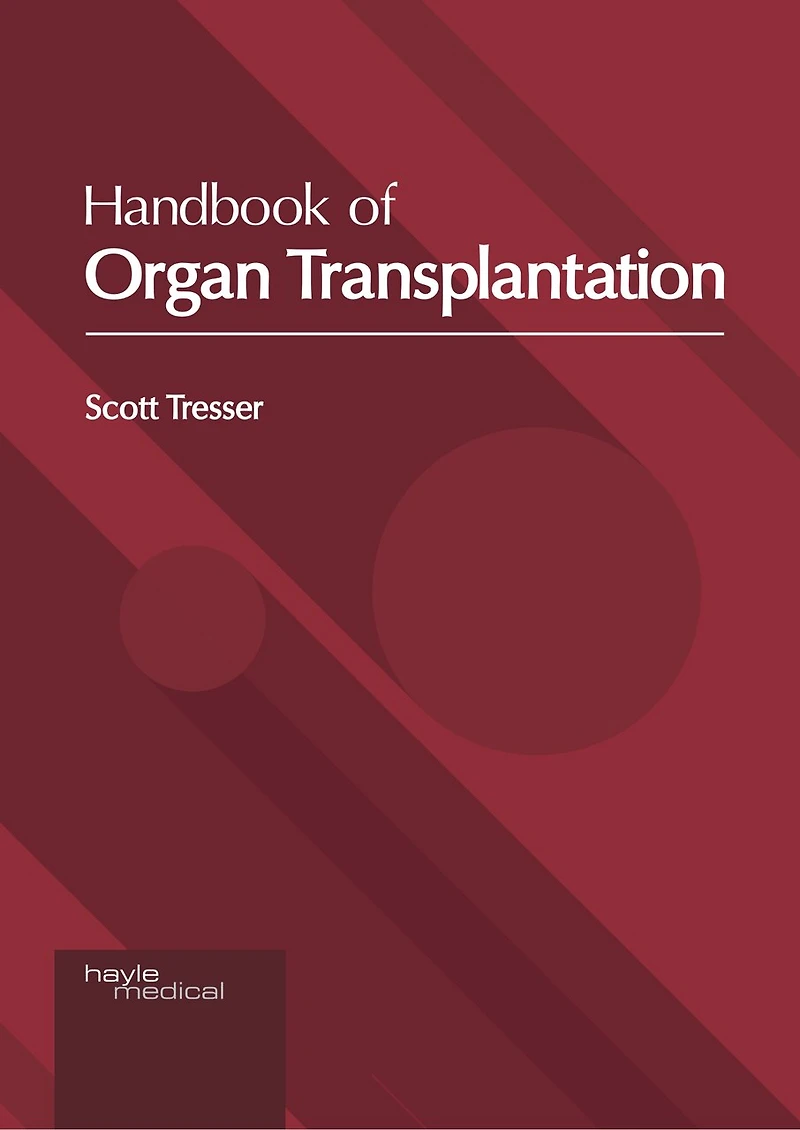 Handbook Of Organ Transplantation