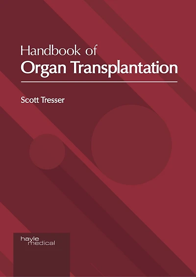 Handbook Of Organ Transplantation