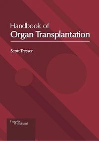 Handbook Of Organ Transplantation
