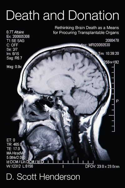 Death and Donation: Rethinking Brain as a Means for Procuring Transplantable Organs