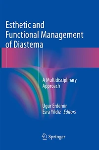 Esthetic and Functional Management of Diastema: A Multidisciplinary Approach