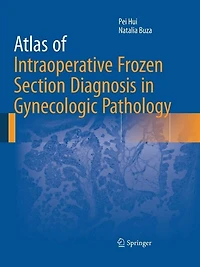 Atlas of Intraoperative Frozen Section Diagnosis Gynecologic Pathology