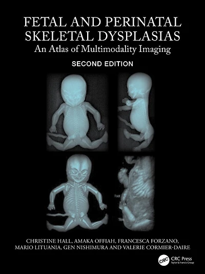 Fetal and Perinatal Skeletal Dysplasias: An Atlas of Multimodality Imaging