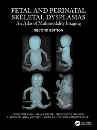 Fetal and Perinatal Skeletal Dysplasias: An Atlas of Multimodality Imaging