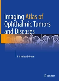 Imaging Atlas of Ophthalmic Tumors and Diseases