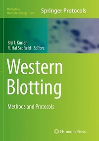 Western Blotting: Methods And Protocols
