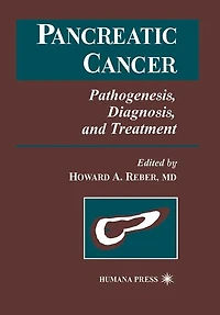 Pancreatic Cancer: Pathogenesis, Diagnosis, and Treatment