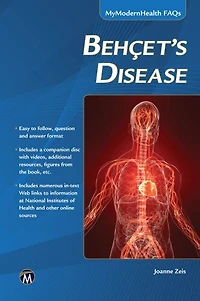 Behcet’s Disease